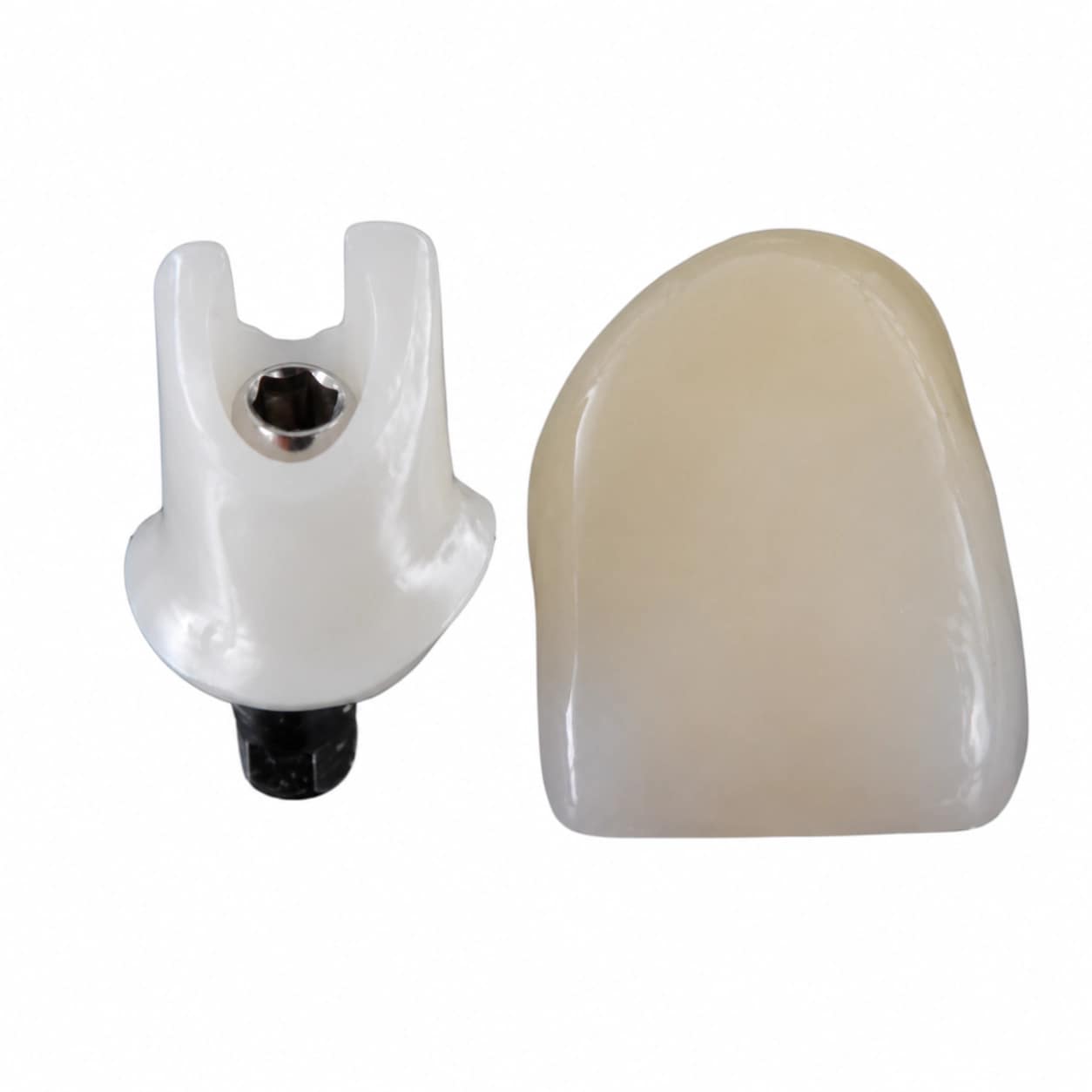 Custom implant abutment restoration