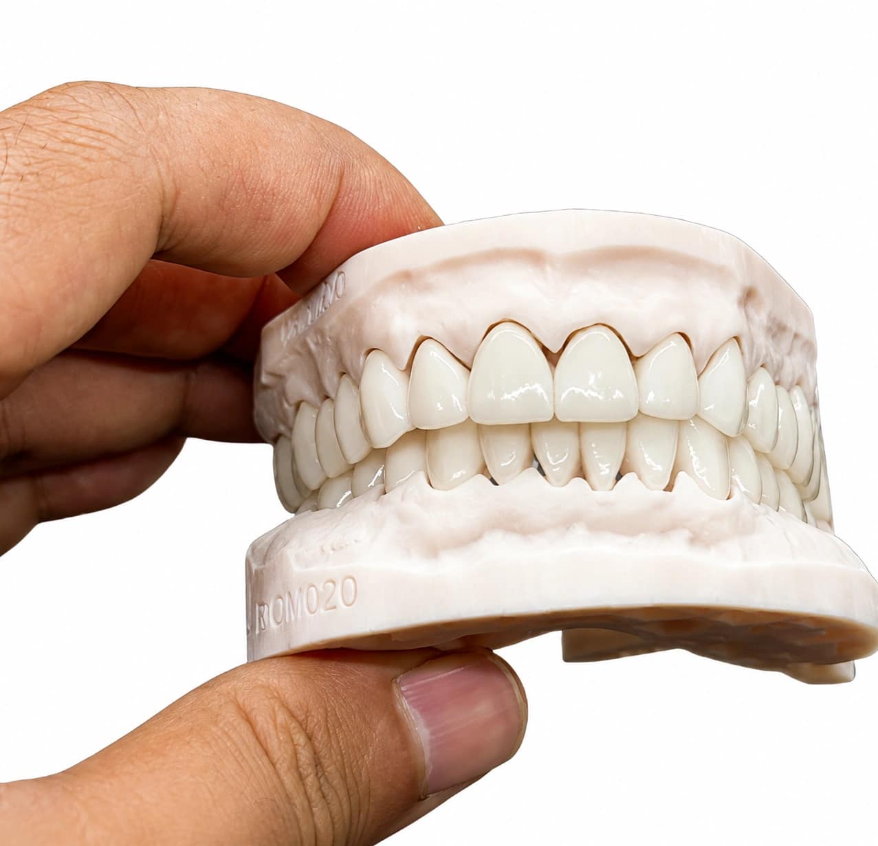 Full zirconia crown dental restoration