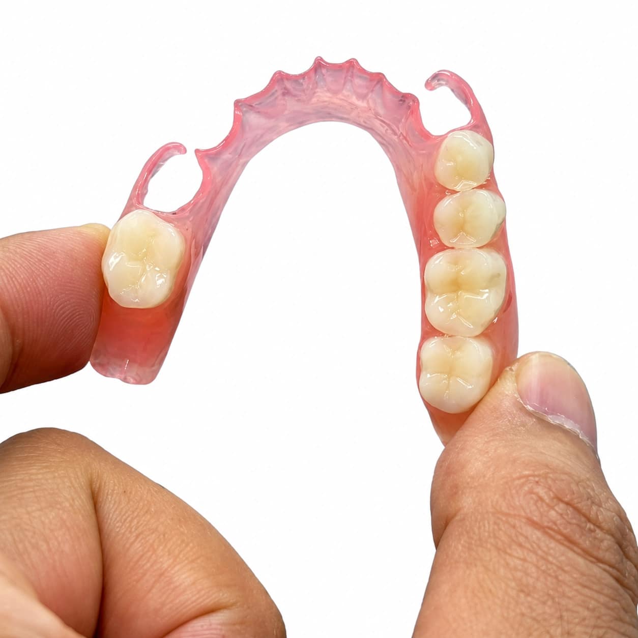 Partial denture removable restoration
