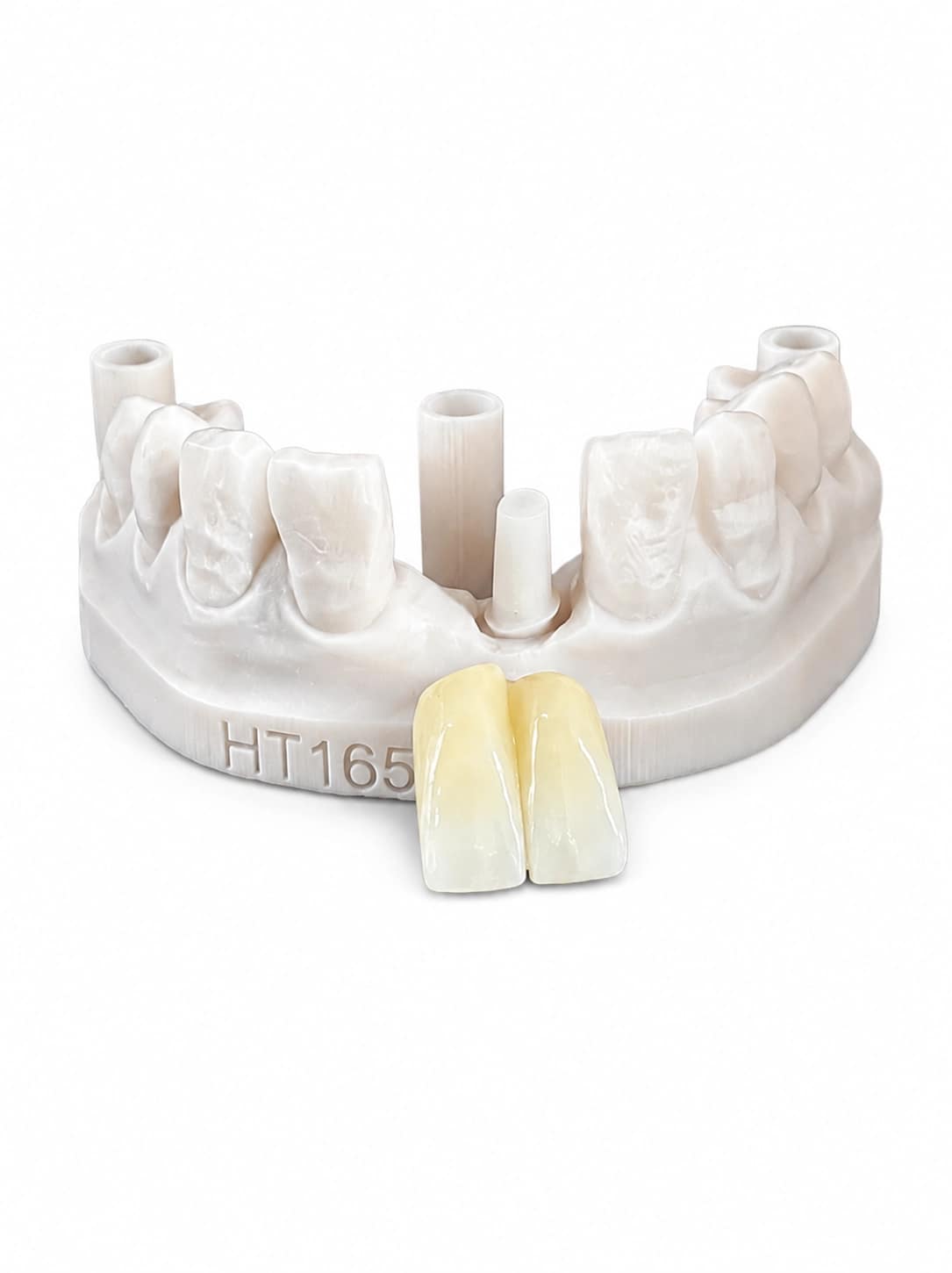 Screw-retained implant crown restoration