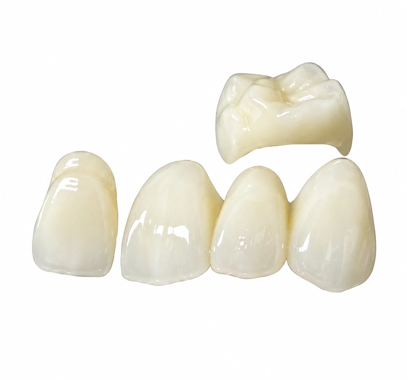 Zirconia bridge dental restoration